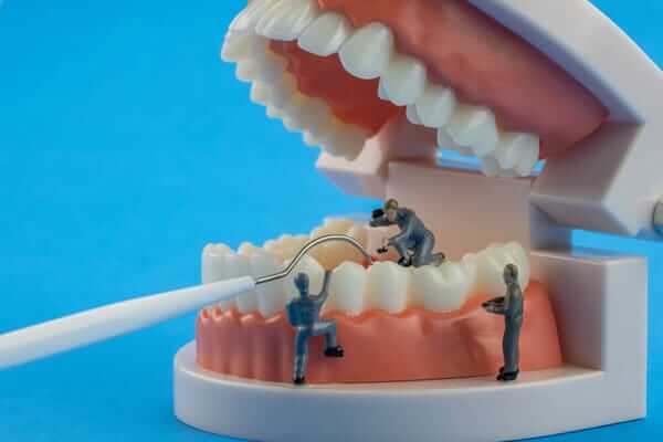 牙周病治療方式介紹