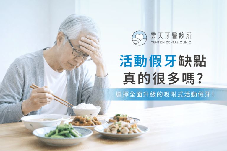 活動假牙缺點